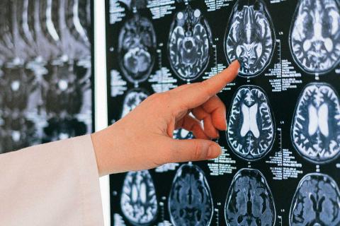 radiografia cervello