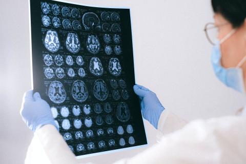 radiografia cervello