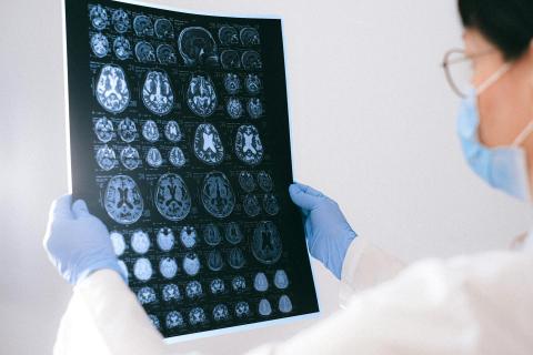 Ricerca su malattie neurodegenerative